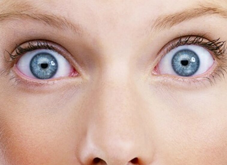 Липосакция помогла женщине вернуть зрение?