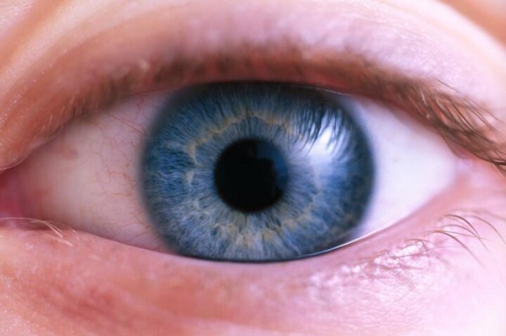 Синдром сухого глаза в офтальмологической практике